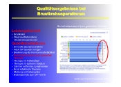 Qualittsergebnisse bei Brustkrebsoperationen